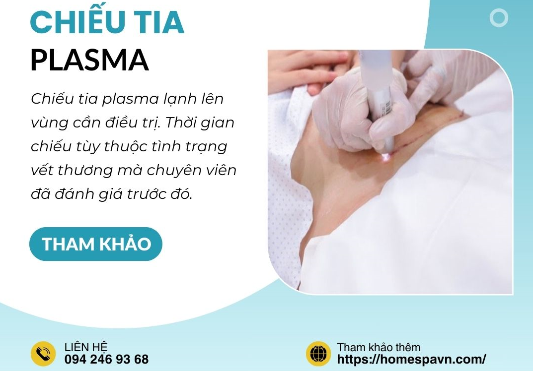 chiếu plasma Bắc Ninh